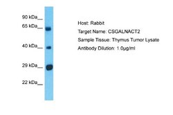 CSGALNACT2 Rabbit anti-Human, Polyclonal, Novus Biologicals 0.1ml; Unconjugated:Antibodies,